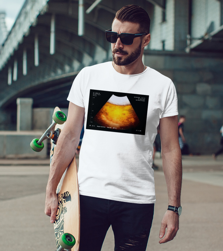 Beer Ultrasound Image Not Safe For Liver T-Shirt